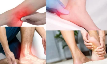 Topuk Ağrısı Nedir?