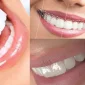 Diş Tasarımı Nedir ve Neden Önemlidir?