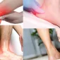 Topuk Ağrısı Nedir?